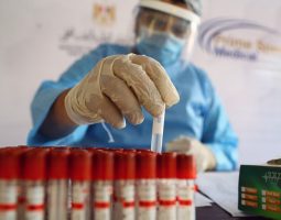 Estudian la respuesta del sistema inmune al coronavirus